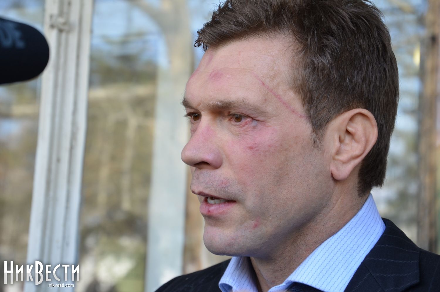 Видео: депутату Рады Цареву поставили синяк под глазом в Николаеве
