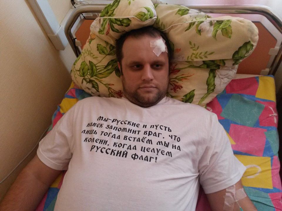 Губарев опубликовал свое фото после покушения с пластырем на лбу