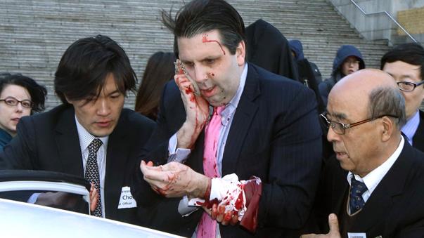 Фото: на посла США в Сеуле с бритвой напал сторонник объединения с КНДР