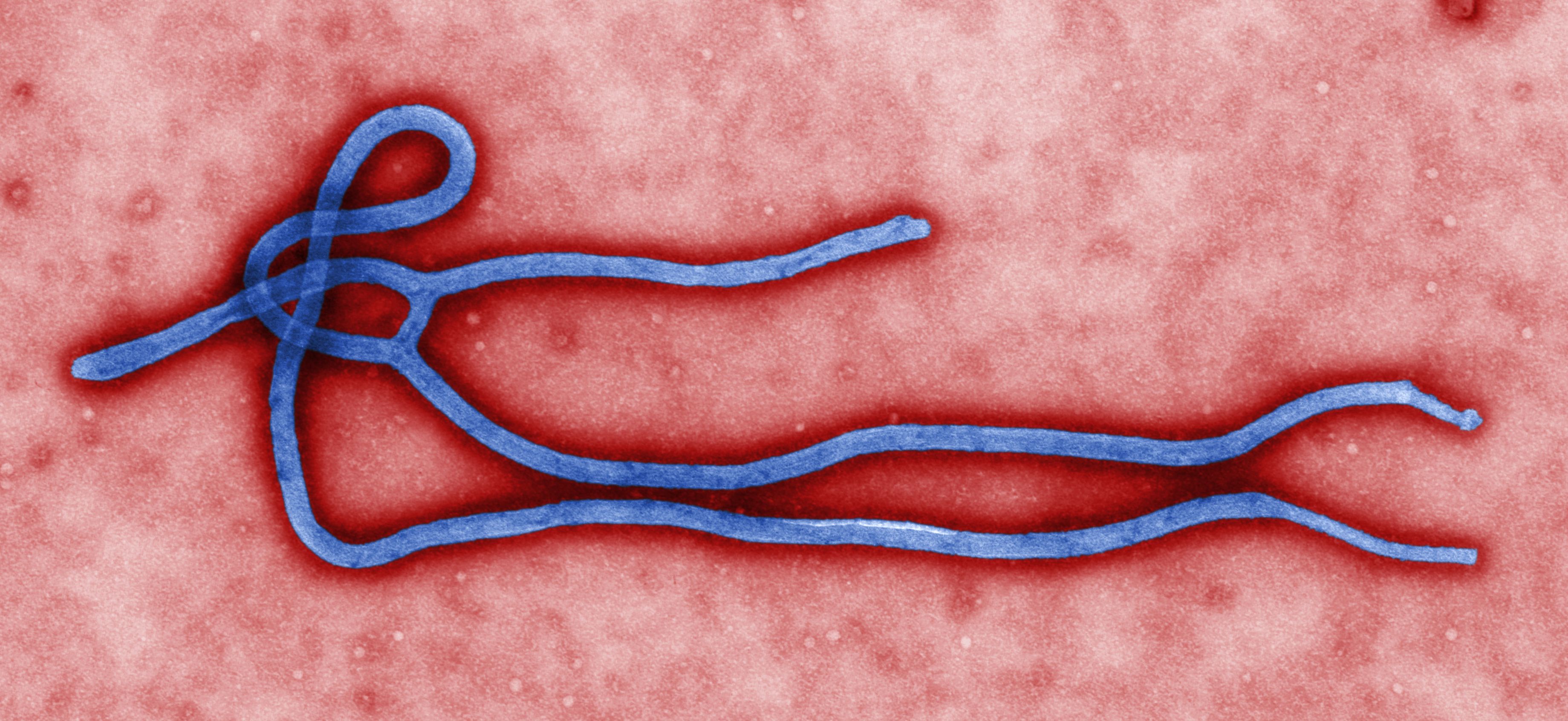 Ученые нашли способ блокировать вирус Эболы