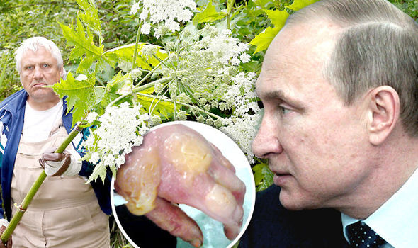 Британское издание обвинило Путина в нашествии на страну ядовитого борщевика