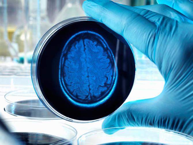 В США ученые вырастили в лаборатории копию человеческого мозга