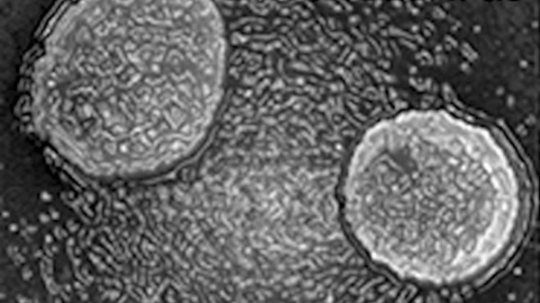 Ученые оживили гигантский древний вирус с Колымы