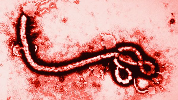 ebola-virus-magnified