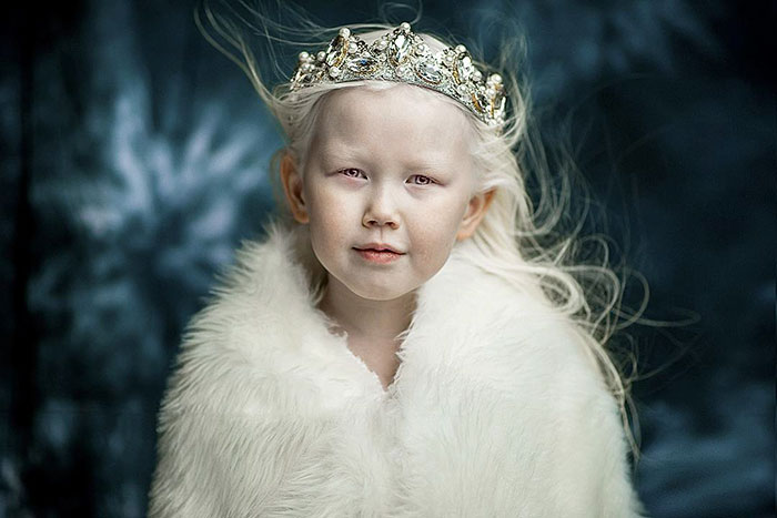 «Сибирская белоснежка». 8-летняя девочка-альбинос из Якутии покоряет модельные агентства и интернет