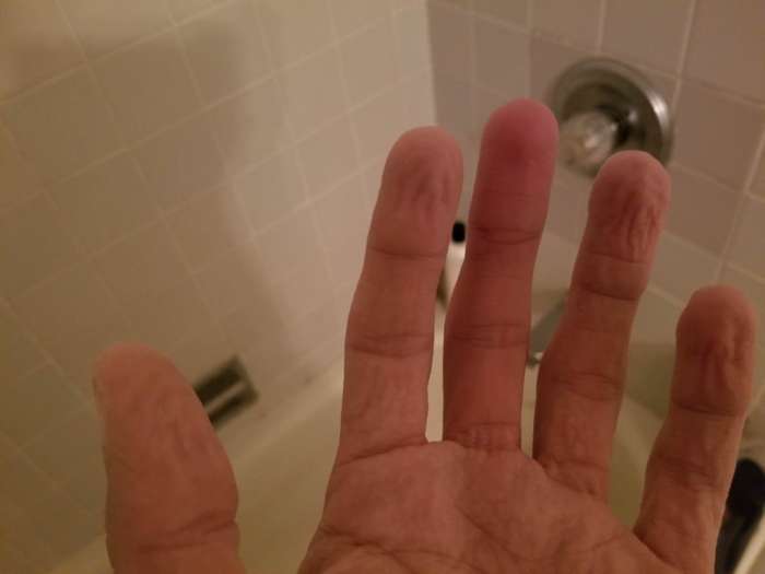 Почему кожа на пальцах становится морщинистой в воде | Научпоп. Наука для всех | Дзен