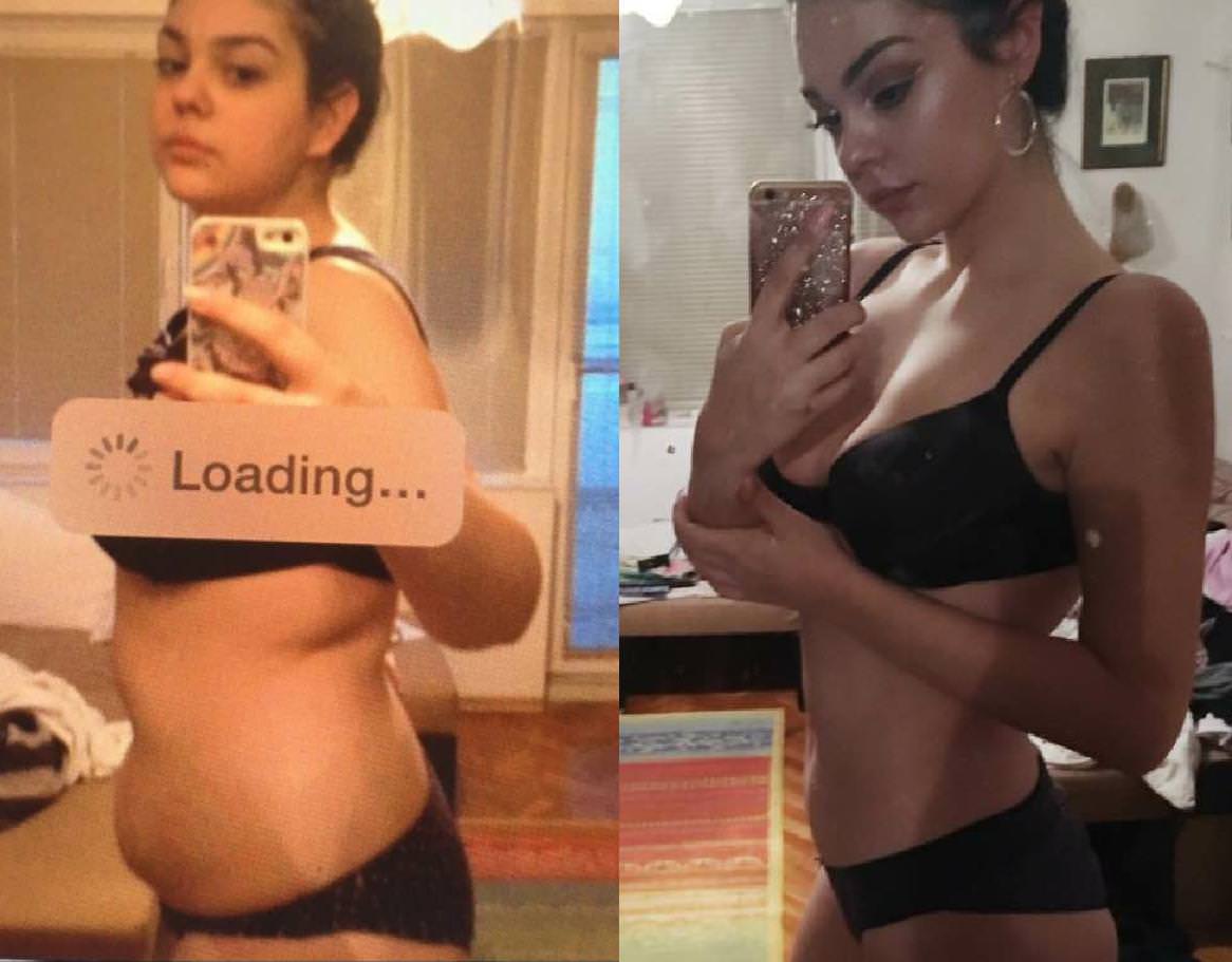 Лицо до и после похудения на 10 кг