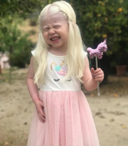 У девочки оказался ген альбинизма, который передается по наследству