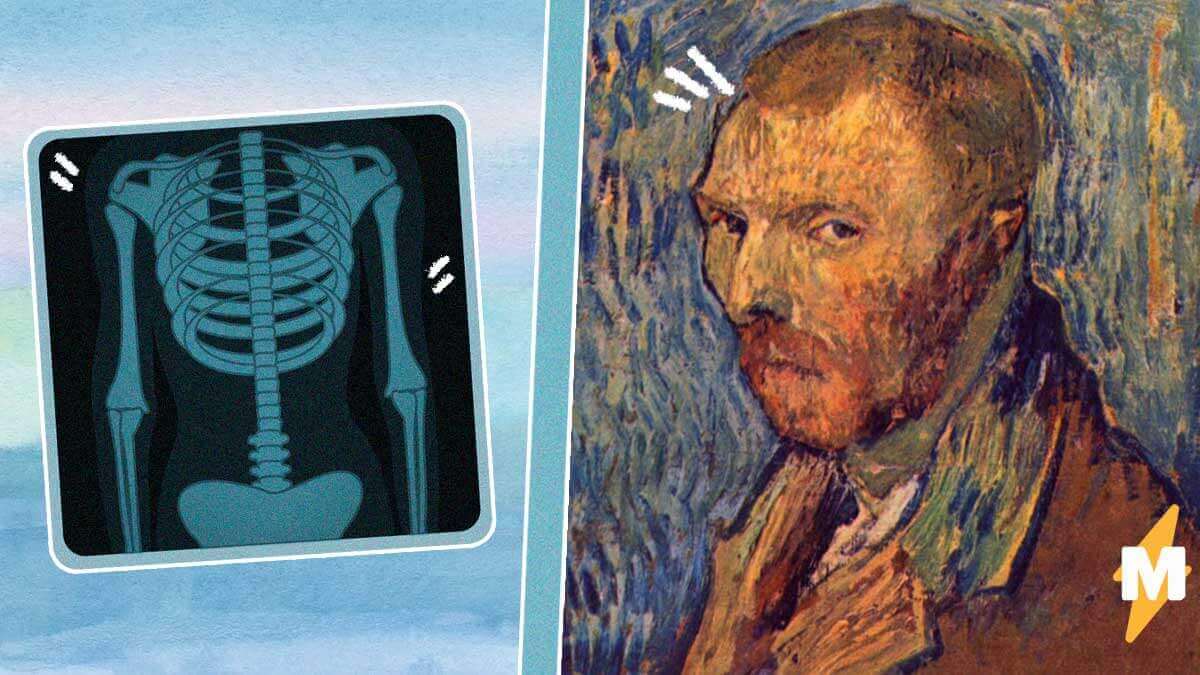 Самый загадочный портрет Ван Гога оказался подлинным. Эксперты ломали голову 50 лет, а помог рентген
