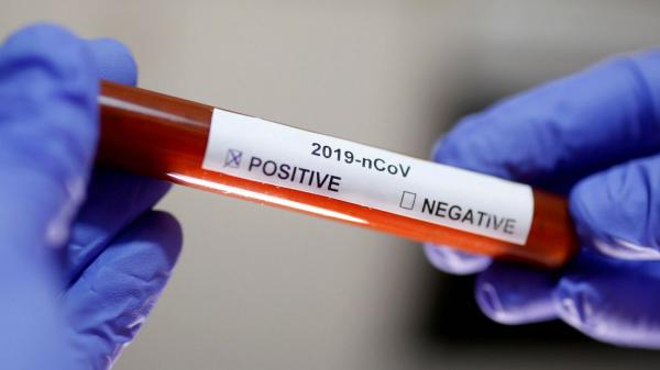 Тест на коронавирус теперь можно сдать бесплатно - по полису ОМС. Но платных возможностей в Москве больше