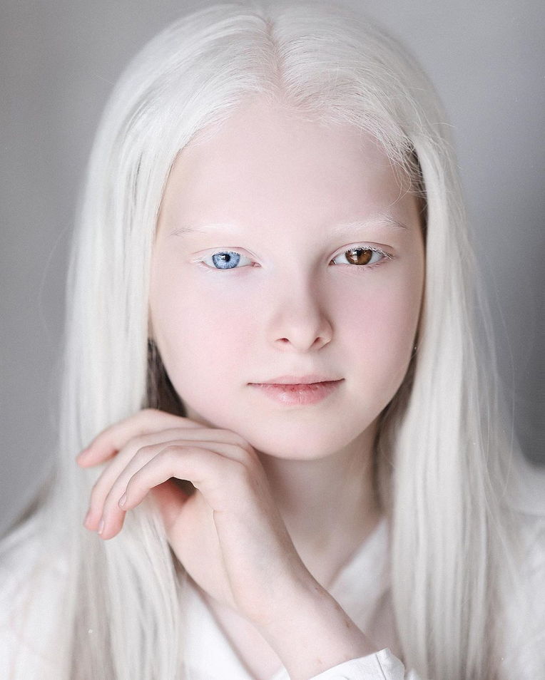 Девушка альбинос - обои для рабочего стола