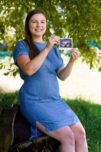 Девушка забеременела один раз, а рожать придётся дважды. "Спасибо" природе, которая сделала из неё две мамы
