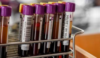 Учёные выяснили, какая группа крови реже болеет COVID-19. Но радоваться её обладателям пока ещё рано
