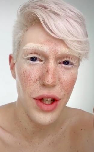 Блогер рассказал, как трудно живётся альбиносам. Но людям его не жаль, ведь такая внешность ранит их чувства