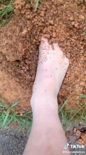Что будет, если засунуть голую ногу в муравейник? Тиктокер узнал и ему больно, но не только из-за укусов