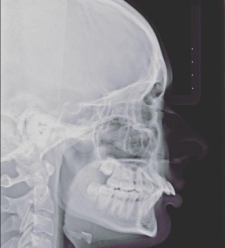 Девушка показала рентген черепа и напомнила о "Симпсонах". Чудеса начались, когда люди увидели лицо девушки