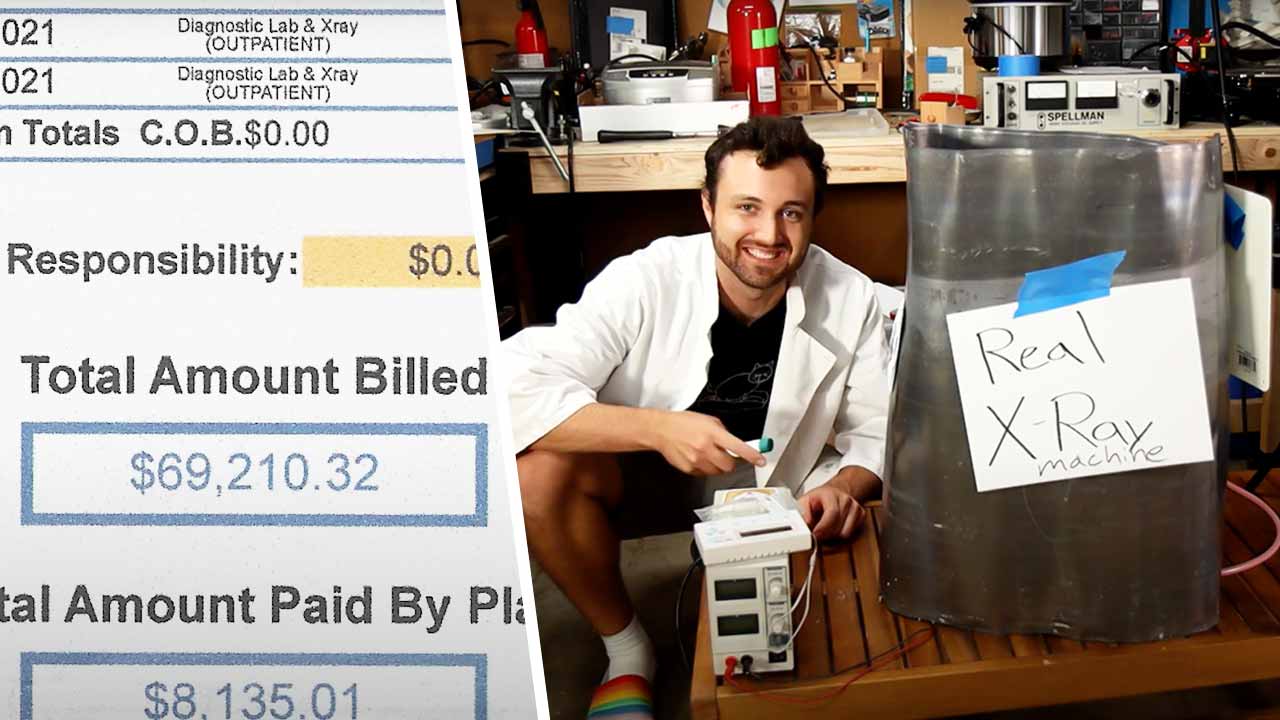 Блогер полечился на $ 70 тысяч и решил построить свой аппарат для рентгена. Он из банок, но работает