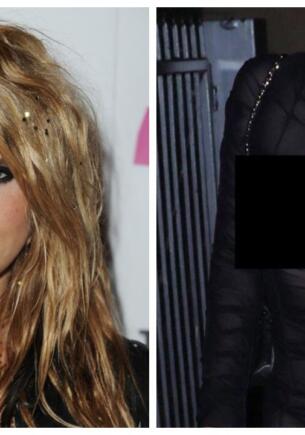 Как сейчас выглядит Kesha. На фото с отёкшей звездой зрители еле узнают дерзкую певицу из 2010-х