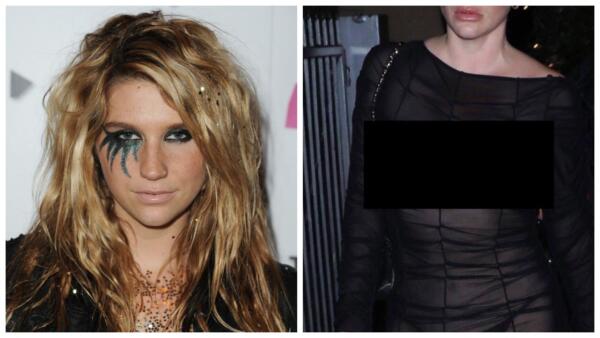 Как сейчас выглядит певица Kesha из нулевых. На снимках 2022-го лицо звезды опухло как после ботокса