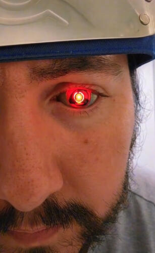Парень из США потерял глаз из-за рака и соорудил протез с фонариком. На видео выглядит как киборг