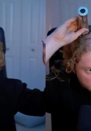 Стример на Twitch случайно показал вмятину от наушников на голове. Так аксессуар продавливает кожу
