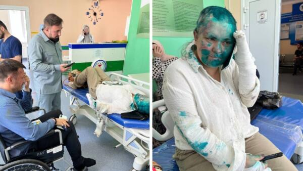 В Чечне избили Елену Милашину и Александра Немова. На фото журналистка с бритой головой в зелёнке
